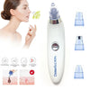 Blackhead Removal (Cell Operated) Machine - Derma Suction 4 in 1